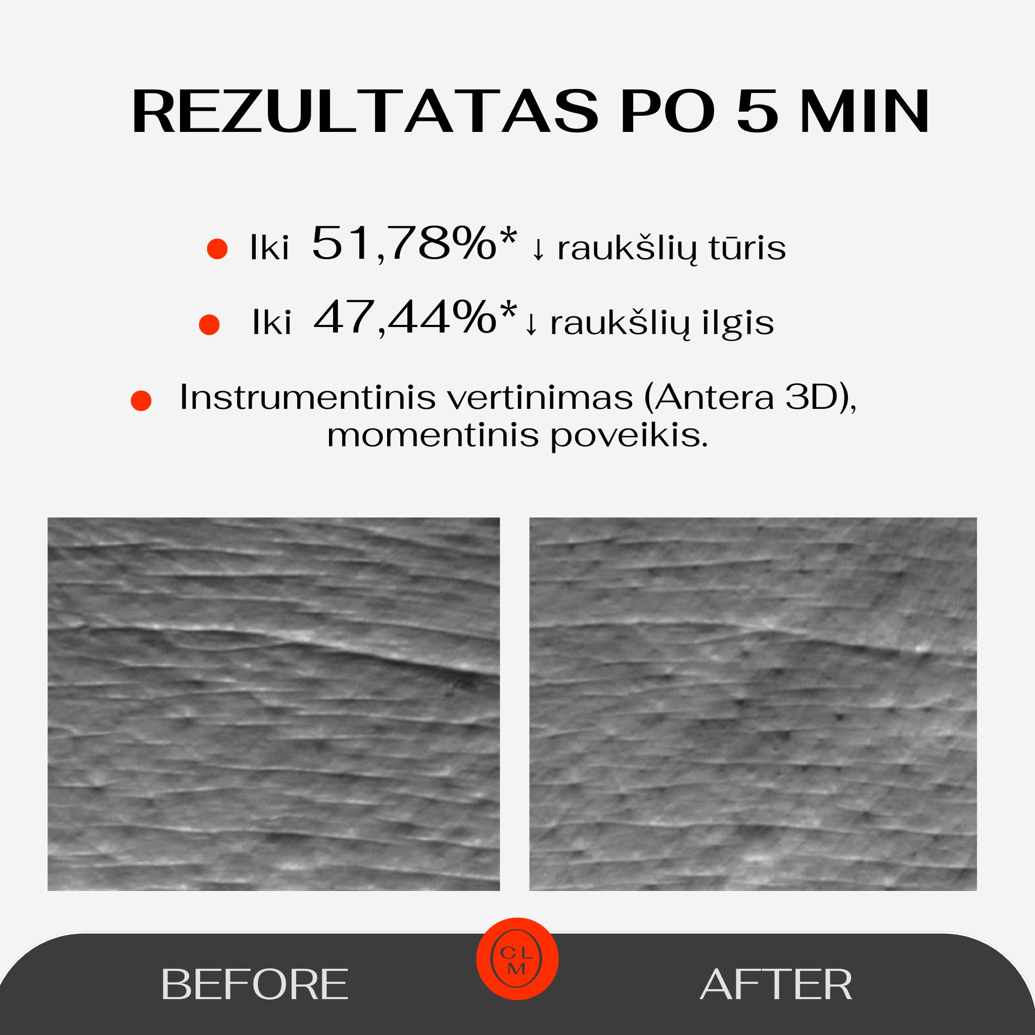 5 Minute Revolution Under-Eye Patches