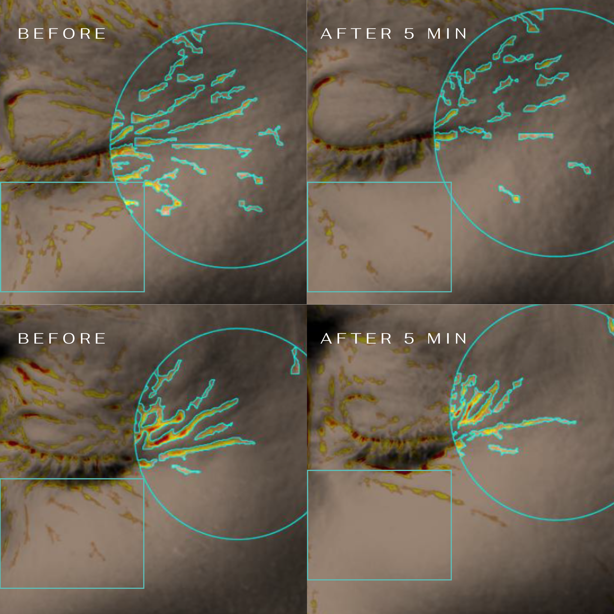 5 Minute Revolution Under-Eye Patches
